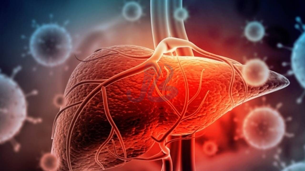 आज विश्व हेपाटाइटिस दिवस: बी र सी बाट सङ्क्रमित १० मध्ये ९ जना अझै बेखबर